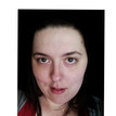 matches thumb