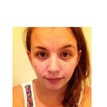 matches thumb