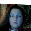 matches thumb