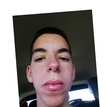 matches thumb