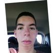 matches thumb