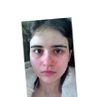 matches thumb