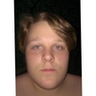 matches thumb